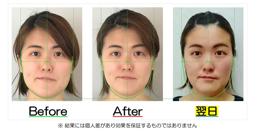 滋賀県守山市の小顔矯正エステ プリュムレーヴ 歪み改善に自信あり