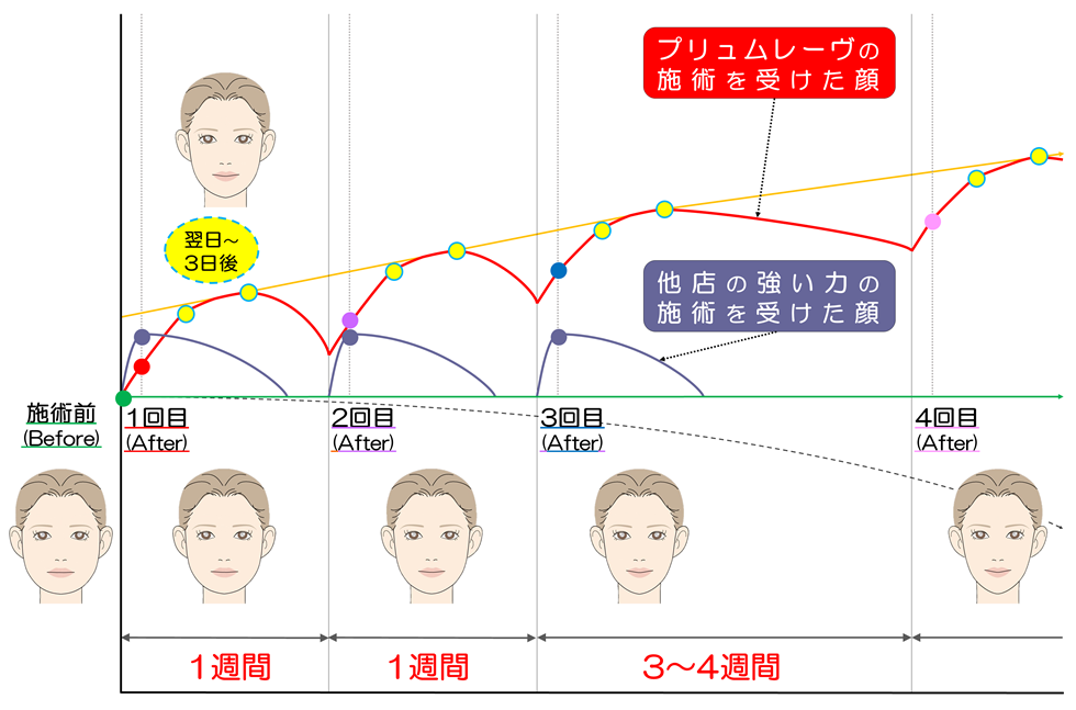 滋賀県守山市の小顔矯正プリュムレーヴ　他店とは違う効果が長持ちする理由